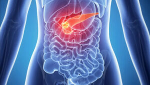 Cancro al pancreas: ecco i 7 sintomi da non ignorare