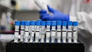 Un vaccino costruito sul tumore di ogni paziente supera la fase 3: come funziona