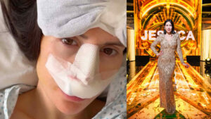 Jessica Morlacchi operata al naso per la quinta volta: “Spero di tornare a respirare con tutte e due le narici”
